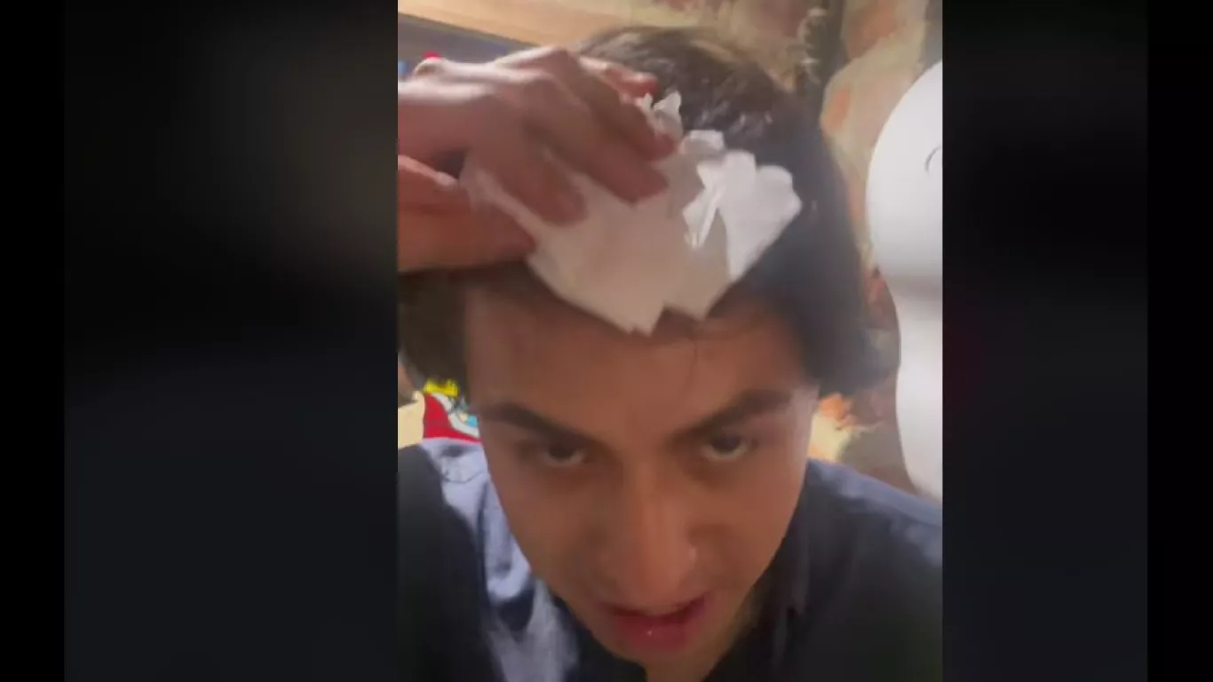Cabeza rota