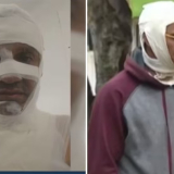 Hombre atacado con ácido en Bogotá